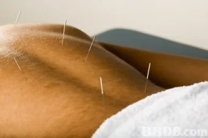 Acupressure, Therapy, Ayurveda Therapy