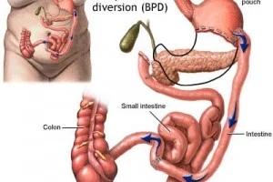 Gastroenterology in Kerala, Gastroenterology in India, Medical Tours India